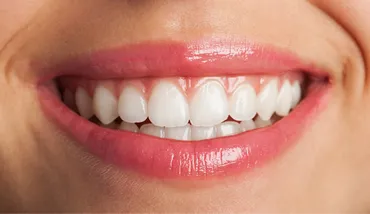 5 Everyday Habits That Could Be Damaging Your Teeth Without You Knowing