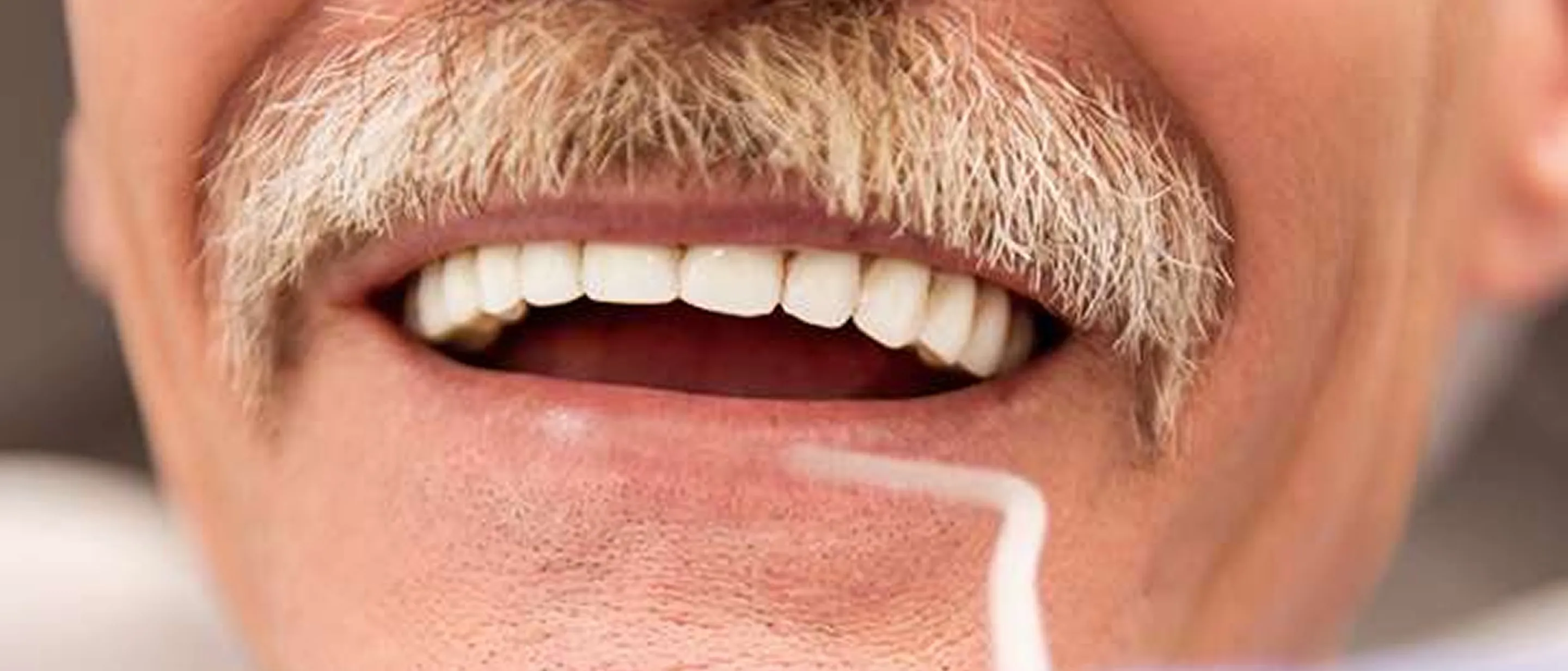 Same day dentures at Crown Dental Group