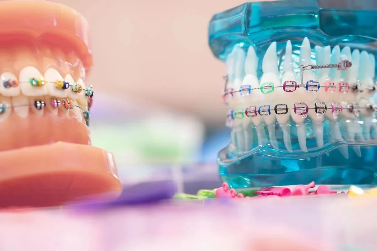 Orthodontic treatment at Crown Dental Group