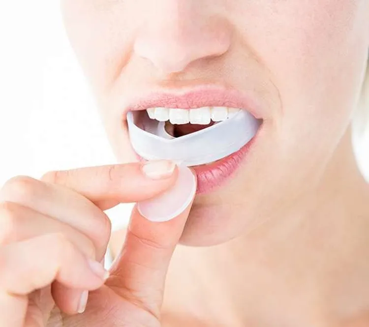 Custom sports mouthguard