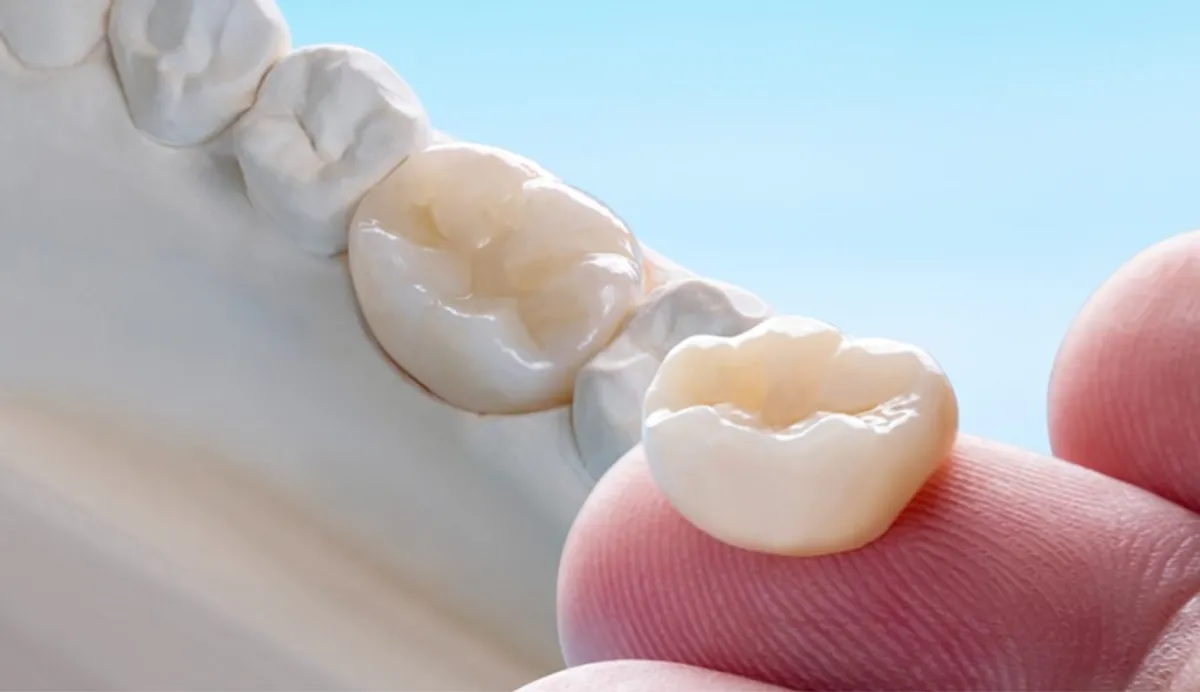 The Complete Guide to Dental Fillings: When You Need Them and What to Expect