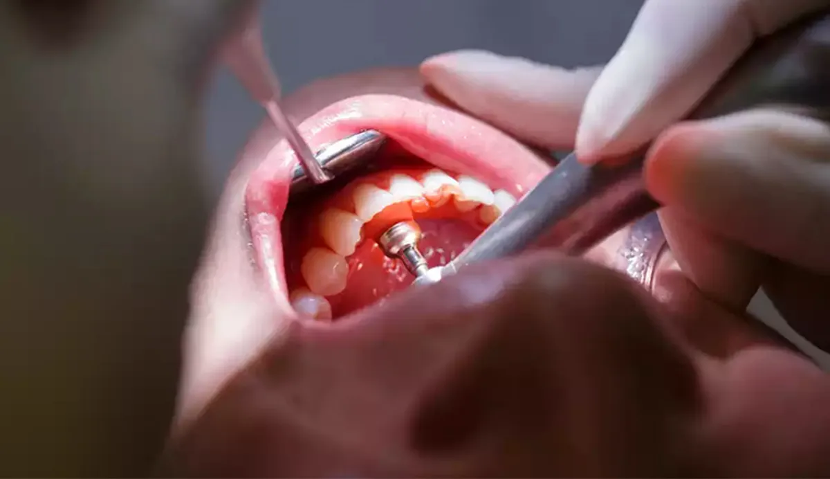 Why Your Gums Matter Just As Much As Your Teeth