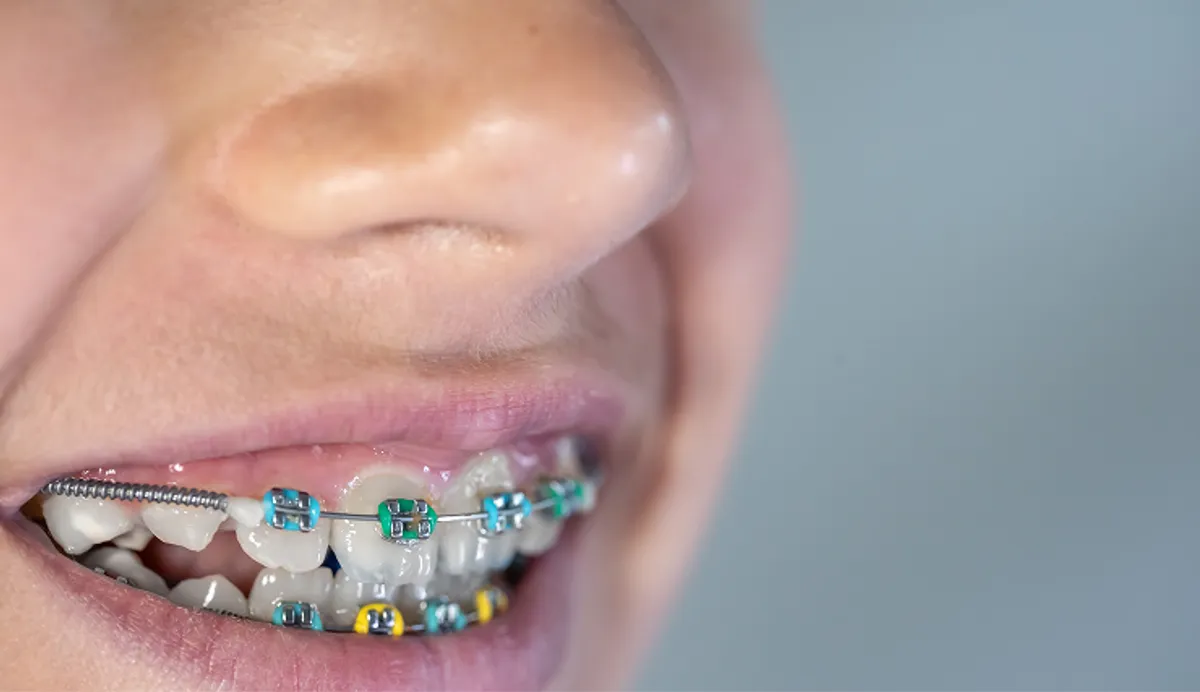 Why Preventive Dentistry Saves You Time, Money, and Stress