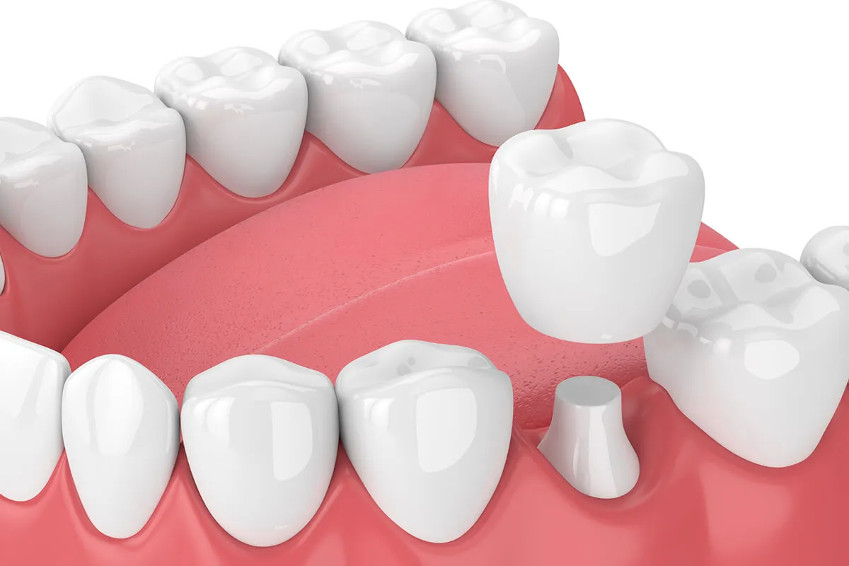 Why Preventative Dentistry Is the Most Valuable Investment You Can Make for Your Smile