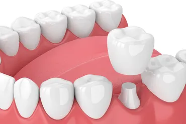 Why Preventative Dentistry Is the Most Valuable Investment You Can Make for Your Smile