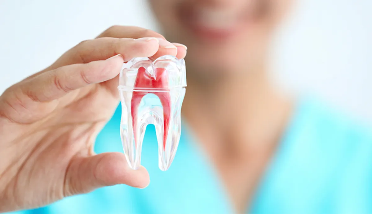 Saving Your Natural Smile: When is a Root Canal Necessary?
