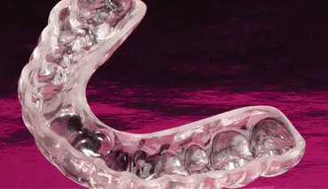 Why You Might Need a Night Guard (And Not Even Know It)