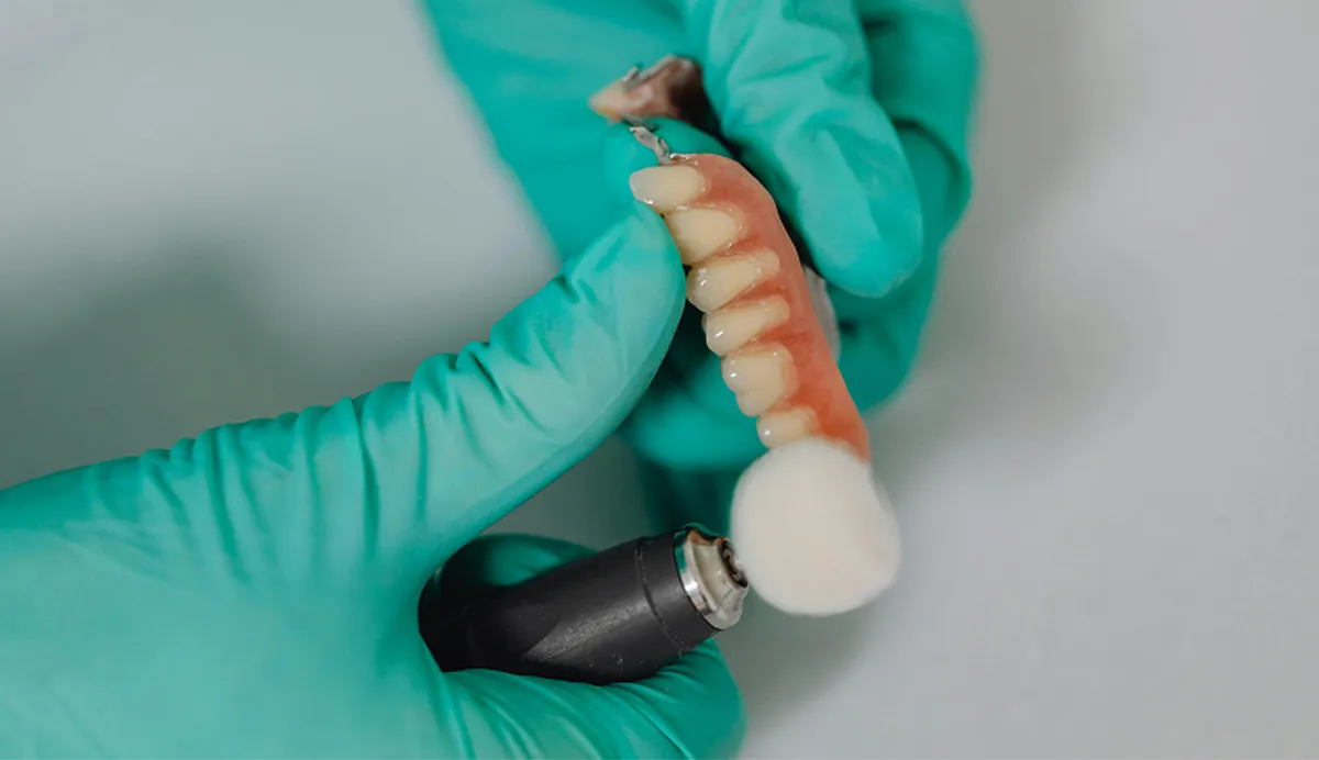 Dental Implants vs. Bridges: Which is Right for Your Smile?