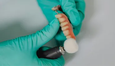 Dental Implants vs. Bridges: Which is Right for Your Smile?