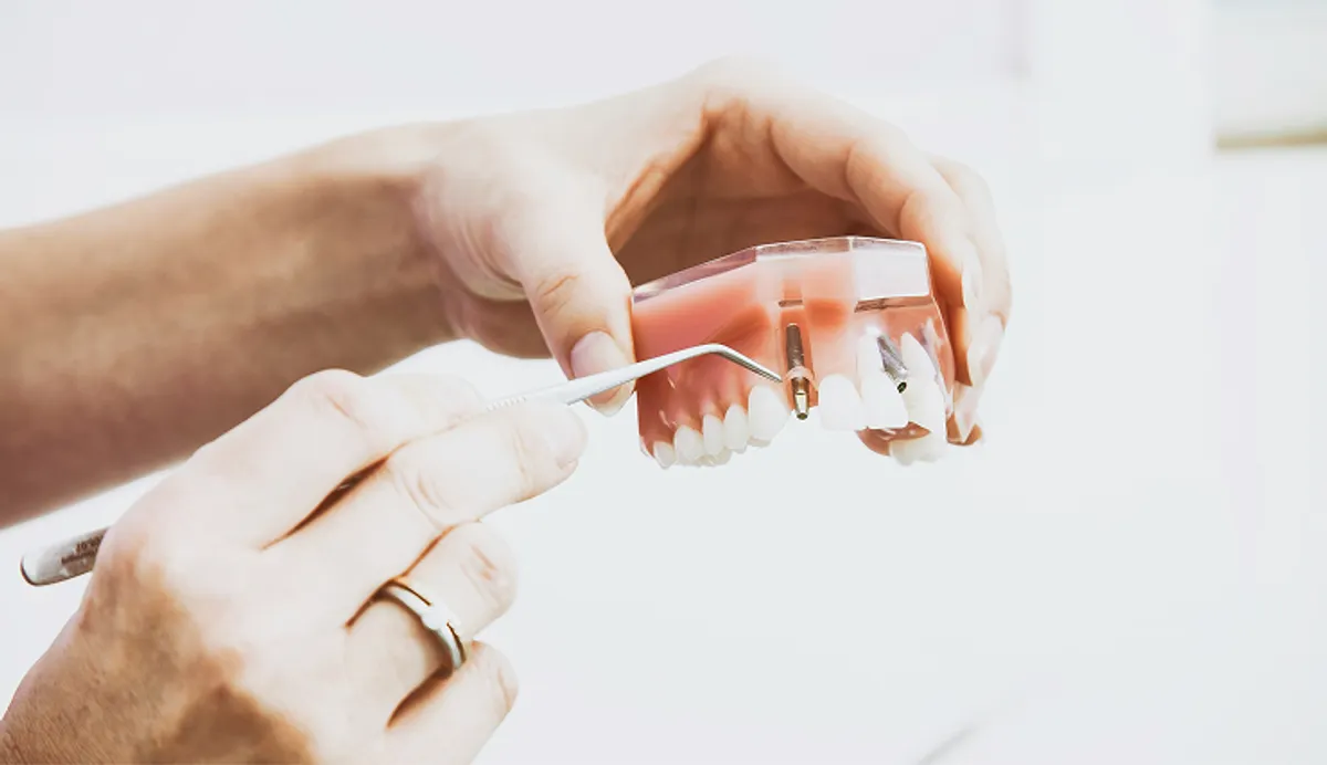 Dental Implants vs. Dentures: Which Tooth Replacement Option Is Right for You?