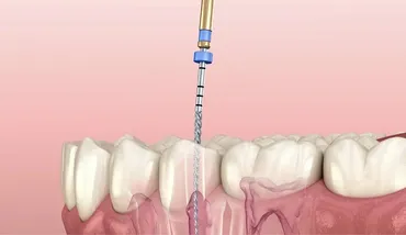 The Preventative Program: Periodontal Health and Systemic Longevity