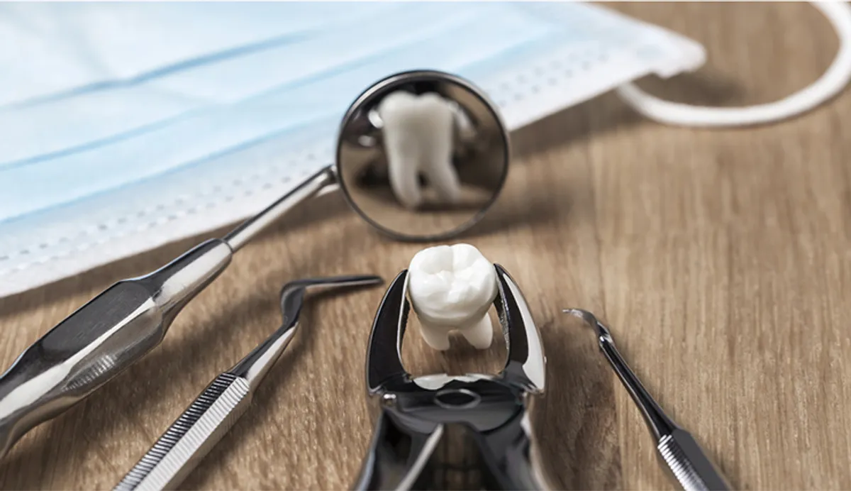 The Extraction Myths: When Removing a Tooth is the Best Choice