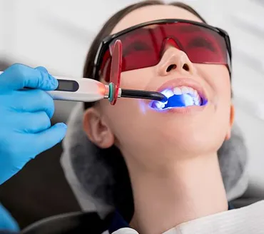 Professional Teeth Whitening in National City, CA: Beyond the Strips
